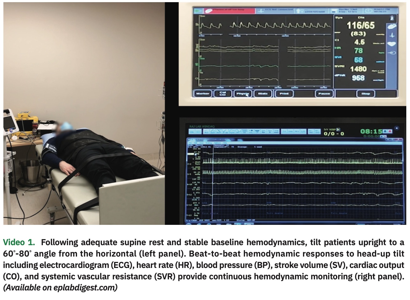 Assessment and Management of Neurogenic Orthostatic Hypotension (nOH